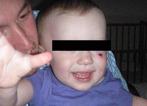 Débarqués de l'avion d'EasyJet cause coupure au visage